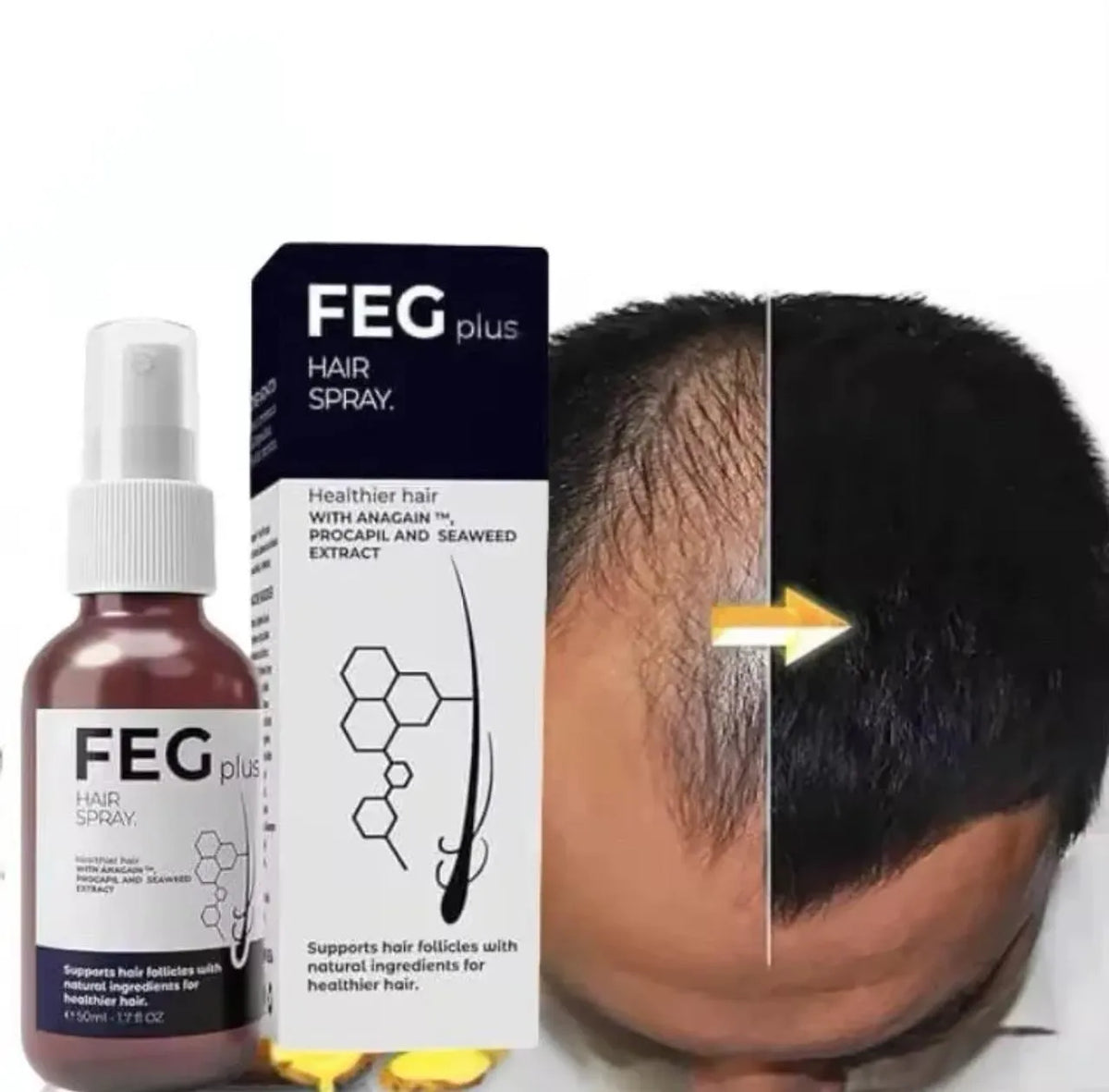 FEG Plus Hair & Beard Growth Spray – Minoxidil, Redensyl & Natural Extracts Formula | 50ml
