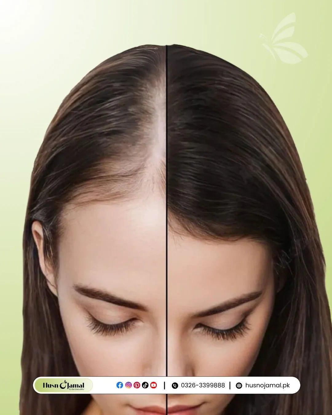 SkinLite Anti-Hairfall Shampoo 200ml | Biotin & Nutrient-Rich Formula | Strengthens Roots & Reduces Hair Loss